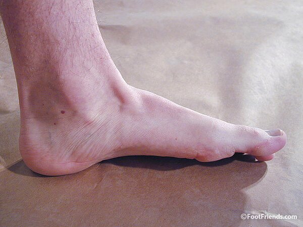 Rusty Rodes shows off his feet and body